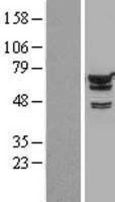 Western Blot IMP2/IGF2BP2 Overexpression Lysate