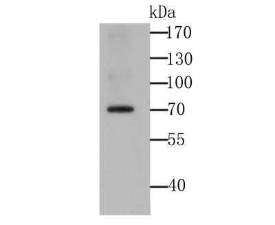 Western Blot: IGF2BP3 Antibody (4-C2-5) [NBP2-76890] - Western blot analysis of IMP3 on 293T cell lysate using anti-IMP3 antibody at 1/2,000 dilution.