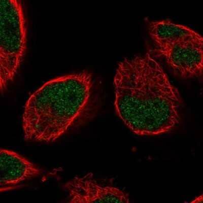 <b>Independent Antibodies Validation. </b>Immunocytochemistry/Immunofluorescence: IGFALS/ALS Antibody [NBP1-89117] - Staining of human cell line U-251 MG shows localization to nucleoplasm. Antibody staining is shown in green.