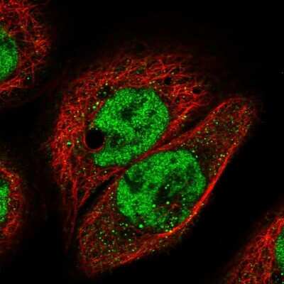 <b>Independent Antibodies Validation. </b>Immunocytochemistry/Immunofluorescence: IGFALS/ALS Antibody [NBP1-89118] - Immunofluorescent staining of human cell line A-431 shows localization to nucleoplasm.  Antibody staining is shown in green.