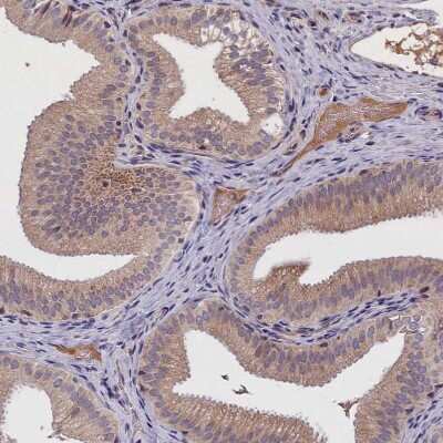 Immunohistochemistry-Paraffin: IGFALS/ALS Antibody [NBP1-89117] - Staining of human gallbladder shows moderate cytoplasmic positivity in glandular cells.