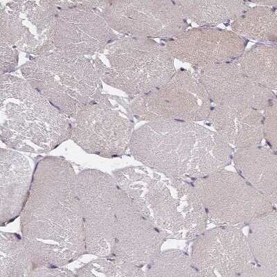 Immunohistochemistry-Paraffin: IGFALS/ALS Antibody [NBP1-89117] - Staining of human skeletal muscle shows moderate positivity in myocytes.