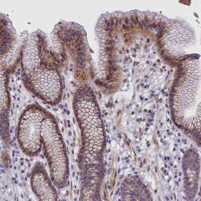 Immunohistochemistry-Paraffin: IGFALS/ALS Antibody [NBP1-89117] - Staining of human stomach shows moderate cytoplasmic positivity in glandular cells.