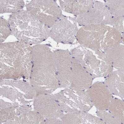 Immunohistochemistry-Paraffin: IGFALS/ALS Antibody [NBP1-89118] - Staining of human skeletal muscle shows no positivity in myocytes.