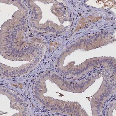 Immunohistochemistry-Paraffin: IGFALS/ALS Antibody [NBP1-89118] - Staining of human gallbladder shows weak cytoplasmic positivity in glandular cells.