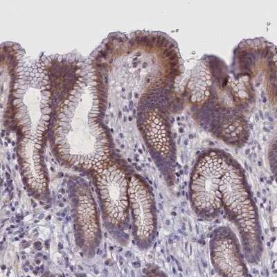 Immunohistochemistry-Paraffin: IGFALS/ALS Antibody [NBP1-89118] - Staining of human stomach shows moderate cytoplasmic positivity in glandular cells.