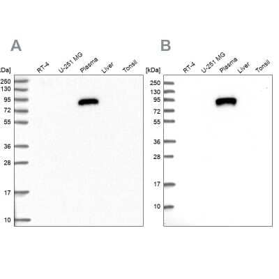 Western Blot: IGFALS/ALS Antibody [NBP1-89117] - Analysis using Anti-IGFALS antibody NBP1-89117 (A) shows similar pattern to independent antibody NBP1-89118 (B).