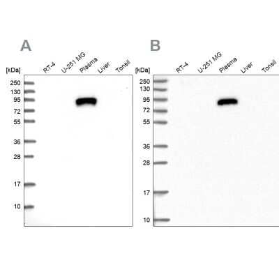 Western Blot: IGFALS/ALS Antibody [NBP1-89118] - Analysis using Anti-IGFALS antibody NBP1-89118 (A) shows similar pattern to independent antibody NBP1-89117 (B).