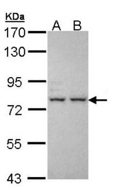 Western Blot: IGFALS Antibody [NBP1-32874] - Sample (30 ug of whole cell lysate) A: H1299 B: Hela 7.5% SDS PAGE; antibody diluted at 1:1000.