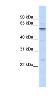 Western Blot: IGFALS Antibody [NBP1-59141] - Titration: 0.2-1 ug/ml, Positive Control: Human brain.