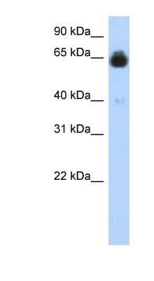 Western Blot: IGFALS Antibody [NBP1-59164] - Titration: 0.2-1 ug/ml, Positive Control: Transfected 293T.