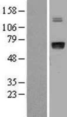 Western Blot: IGFALS Overexpression Lysate (Adult Normal) [NBL1-11872] Left-Empty vector transfected control cell lysate (HEK293 cell lysate); Right -Over-expression Lysate for IGFALS.