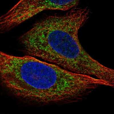 Immunocytochemistry/Immunofluorescence: IGFBP-2 Antibody [NBP2-57978] - Staining of human cell line U-2 OS shows localization to endoplasmic reticulum.
