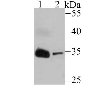 Western Blot: IGFBP-2 Antibody (JU37-46) [NBP2-75535] - Analysis of IGFBP2 on Human serum (1) and NCCIT (2) lysates using anti-IGFBP2 antibody at 1/500 dilution.