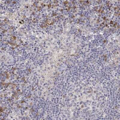 Immunohistochemistry: IGFBP-4 Antibody [NBP2-38086] - Staining of human lymph node shows moderate cytoplasmic positivity in subset of non-germinal center cells.