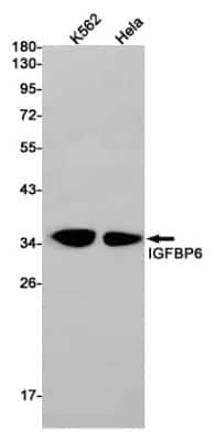 Western Blot: IGFBP-6 Antibody (S02-6G2) [NBP3-14896] - Western blot detection of IGFBP-6 in K562, Hela cell lysates using IGFBP-6 Rabbit mAb (1:1000 diluted). Predicted band size: 25kDa. Observed band size: 35kDa.