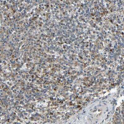 Immunohistochemistry-Paraffin IGFBP-rP10/KAZALD1 Antibody - BSA Free