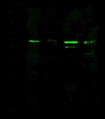 Western Blot: IGFBP-rP10/KAZALD1 Antibody [NBP2-98914] - Anti-IGFBP-rP10/KAZALD1 rabbit polyclonal antibody at 1:500 dilution. Lane A: HepG2 Whole Cell Lysate. Lane B: Hela Whole Cell Lysate. Lane C: A431 Whole Cell Lysate. Lane D: THP1 Whole Cell Lysate. Lysates/proteins at 30 ug per lane. Secondary Goat Anti-Rabbit IgG H&L (Dylight 800) at 1/10000 dilution. Developed using the Odyssey technique. Performed under reducing conditions. Predicted band size: 33 kDa. Observed band size: 45 kDa (We are unsure as to the identity of these extra bands).