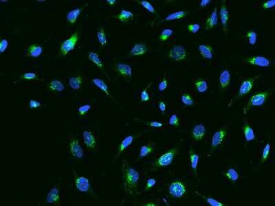 Immunocytochemistry/Immunofluorescence: IGFBP-rp1/IGFBP-7 Antibody (003) [NBP2-90174] - Immunofluorescence staining of IGFBP-rp1/IGFBP-7 in Hela cells. Cells were fixed with 4% PFA, permeabilized with 0.1% Triton X-100 in PBS, blocked with 10% serum, and incubated with rabbit anti-Human IGFBP7 monoclonal antibody (dilution ratio 1:60) at 4C overnight. Then cells were stained with the Alexa Fluor(TM) 488-conjugated Goat Anti-rabbit IgG secondary antibody (green) and counterstained with DAPI (blue).Positive staining was localized to Cytoplasm.