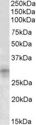 Western Blot: IGFBP-rp1/IGFBP-7 Antibody [NBP1-49861] - Analysis of IGFBP7 (aa145-159) in Mouse Kidney lysate (35ug protein in RIPA buffer) using NBP1-49861 at 1ug/ml. Primary incubation was 1 hour. Detected by chemiluminescence.
