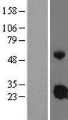 Western Blot: IGFBP4 Overexpression Lysate (Adult Normal) [NBL1-11874] Left-Empty vector transfected control cell lysate (HEK293 cell lysate); Right -Over-expression Lysate for IGFBP4.