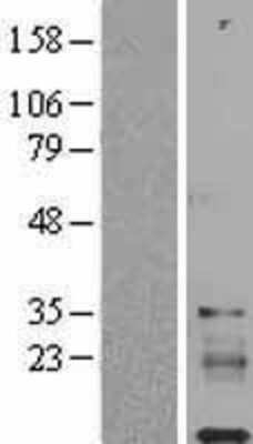 Western Blot: IGFL1 Overexpression Lysate (Adult Normal) [NBL1-11877] Left-Empty vector transfected control cell lysate (HEK293 cell lysate); Right -Over-expression Lysate for IGFL1.