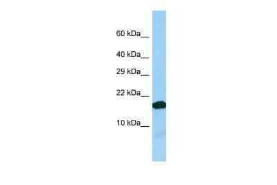 Western Blot: IGFL2 Antibody [NBP3-09570] - Western blot analysis of IGFL2 in Jurkat Whole Cell lysates. Antibody dilution at 1.0ug/ml