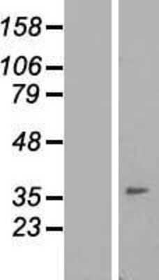 Western Blot: IGFLR1 Overexpression Lysate (Adult Normal) [NBP2-06309] Left-Empty vector transfected control cell lysate (HEK293 cell lysate); Right -Over-expression Lysate for IGFLR1.
