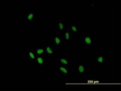 Immunocytochemistry/Immunofluorescence: IGHA2 Antibody [H00003494-B01P] - Analysis of purified antibody to IGHA2 on HeLa cell. (antibody concentration 10 ug/ml)
