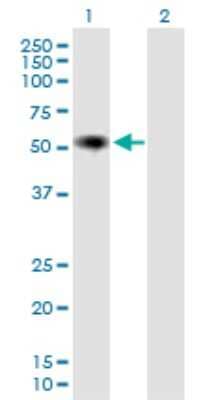 Western Blot: IGHA2 Antibody [H00003494-B01P] - Analysis of IGHA2 expression in transfected 293T cell line by IGHA2 polyclonal antibody.  Lane 1: IGHA2 transfected lysate(52.47 KDa). Lane 2: Non-transfected lysate.
