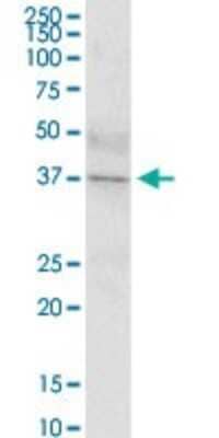 Western Blot: IGHD Antibody [H00003495-B01P] - Analysis of IGHD expression in human kidney.