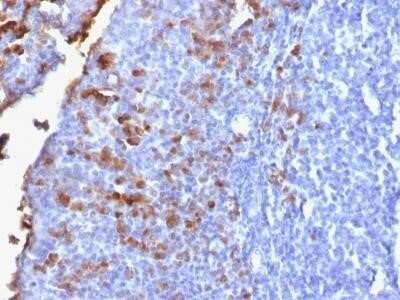 Immunohistochemistry-Paraffin: IGHG1 Antibody (IG1707R) - Azide and BSA Free [NBP2-54449] - Formalin-fixed, paraffin-embedded human Tonsil stained with IgG Rabbit Recombinant Monoclonal Antibody (IG1707R).