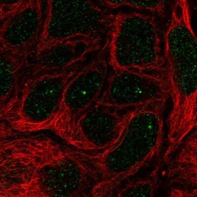 Immunocytochemistry/Immunofluorescence: IGHMBP2 Antibody [NBP2-57526] - Staining of human cell line CACO-2 shows localization to nucleus.