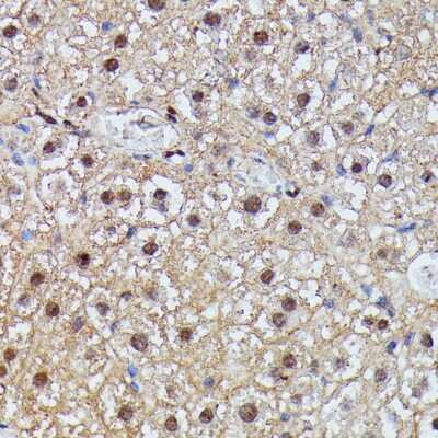 Immunohistochemistry-Paraffin: IGHMBP2 Antibody [NBP3-05096] - Mouse liver using IGHMBP2 antibody at dilution of 1:100 (40x lens).