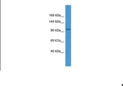 Western Blot: IGHMBP2 Antibody [NBP1-68921] - Mouse Heart.