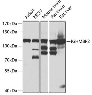 Western Blot: IGHMBP2 Antibody [NBP3-05279] - Analysis of extracts of various cell lines, using IGHMBP2 antibody at 1:1000 dilution. Secondary antibody: HRP Goat Anti-Rabbit IgG (H+L) at 1:10000 dilution. Lysates/proteins: 25ug per lane. Blocking buffer: 3% nonfat dry milk in TBST. Detection: ECL Basic Kit