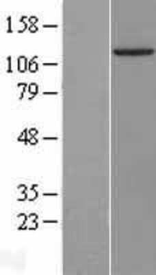 Western Blot: IGHMBP2 Overexpression Lysate (Adult Normal) [NBL1-11878] Left-Empty vector transfected control cell lysate (HEK293 cell lysate); Right -Over-expression Lysate for IGHMBP2.