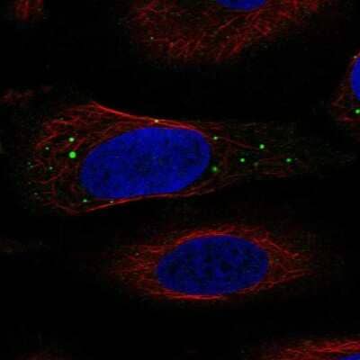 Immunocytochemistry/Immunofluorescence: IGIP Antibody [NBP2-58982] - Staining of human cell line SiHa shows localization to vesicles.