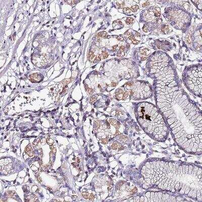 Immunohistochemistry-Paraffin: IGIP Antibody [NBP2-14118] - Staining of human stomach, lower shows moderate cytoplasmic positivity in glandular cells.