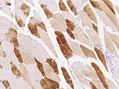 Immunohistochemistry-Paraffin: IGIP Antibody [NBP2-98511] - Immunochemical staining of human IGIP in human skeletal muscle with rabbit polyclonal antibody at 1:100 dilution, formalin-fixed paraffin embedded sections.