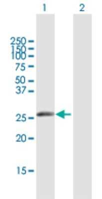 Western Blot: IGKV1-5 Antibody [H00028299-B01P] - Analysis of IGKV1-5 expression in transfected 293T cell line by IGKV1-5 polyclonal antibody.  Lane 1: IGKV1-5 transfected lysate(25.85 KDa). Lane 2: Non-transfected lysate.