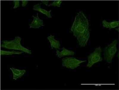 Immunocytochemistry/Immunofluorescence: IGKV1OR2-108 Antibody (3A11) [H00028862-M01] - Analysis of monoclonal antibody to IGKV1OR2-108 on HeLa cell . Antibody concentration 10 ug/ml.