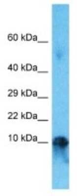 Western Blot: IGLC7 Antibody [NBP3-09920] - Western blot analysis of IGLC7 in Fetal Liver lysates. Antibody dilution at 1.0ug/ml