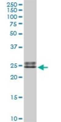 Western Blot: IGLL1 Antibody [H00003543-D01P] - Analysis of IGLL1 expression in human spleen.