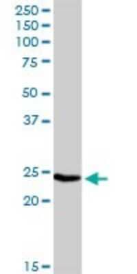 Western Blot: IGLL1 Antibody [H00003543-D01P] - Analysis of IGLL1 expression in mouse spleen.
