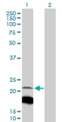 Western Blot: IGLL1 Antibody [H00003543-D01P] - Analysis of IGLL1 expression in transfected 293T cell line by IGLL1 polyclonal antibody.Lane 1: IGLL1 transfected lysate(23.00 KDa).Lane 2: Non-transfected lysate.