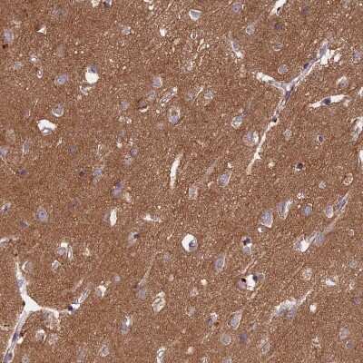 Immunohistochemistry-Paraffin: IGLON5 Antibody [NBP1-93541] - Staining of human cerebral cortex shows strong positivity in neuropil.