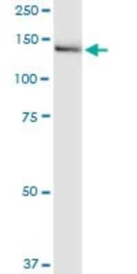 Western Blot: IGSF1 Antibody (4C7) [H00003547-M01] - IGSF1 monoclonal antibody (M01), clone 4C7. Analysis of IGSF1 expression in rat brain.