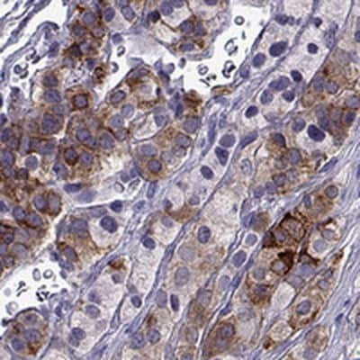 Immunohistochemistry: IGSF1 Antibody [NBP2-68582] - Immunohistochemical staining of human pituitary gland shows strong cytoplasmic positivity in subset of cells in anterior lobe.