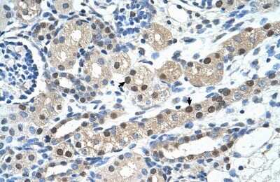 Immunohistochemistry-Paraffin: IGSF1 Antibody [NBP1-59109] - Human kidney Tissue, antibody concentration 4-8ug/ml. Cells with positive label: renal corpuscle cells (indicated with arrows) 400X magnification.